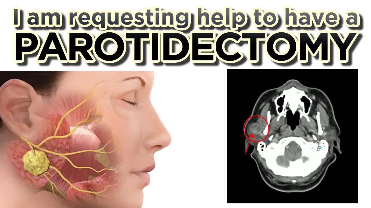 Parotidectomy Fund Raising Campaign